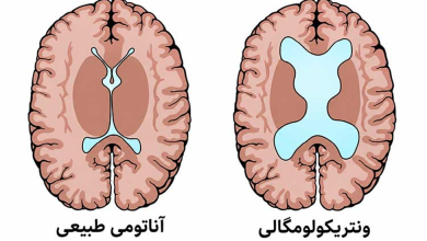 جدول اندازه نرمال بطن مغز جنین