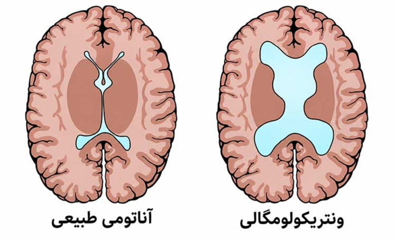 بطن مغز جدول اندازه نرمال بطن مغز جنین